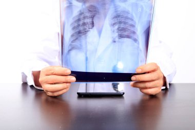 Tıp doktoru hastanedeki akciğerlerin röntgenine bakıyor. Covid-19, kadın doktor hasta odasında röntgen röntgenine bakıyor.