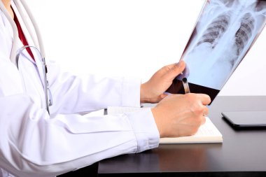 Tıp doktoru hastanedeki akciğerlerin röntgenine bakıyor. Covid-19, kadın doktor hasta odasında röntgen röntgenine bakıyor.