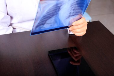 Tıp doktoru hastanedeki akciğerlerin röntgenine bakıyor. Covid-19, kadın doktor hasta odasında röntgen röntgenine bakıyor.