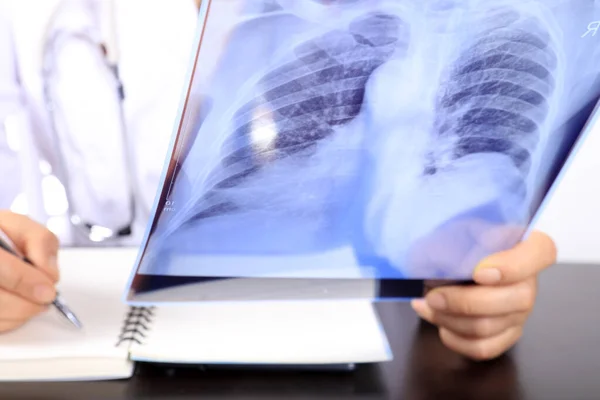 Medical doctor looking at x-ray picture of lungs in hospital. Covid-19 consept, Woman Doctor Looking at X-Ray Radiography in patient\'s Room