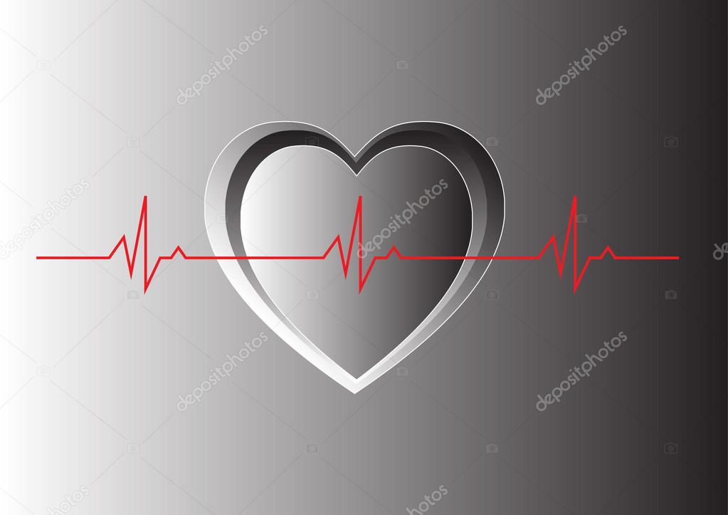 Normal sinus Heart Beat