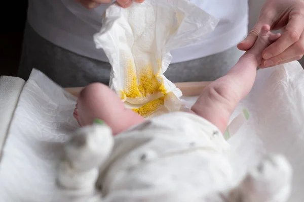Батько міняє брудний смердючий підгузник з жовтою петлею для своєї новонародженої дитини — стокове фото