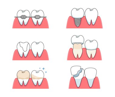 Diş tedavisi. Genel diş prosedürleri ve bakım örneklerinin temsilcisi