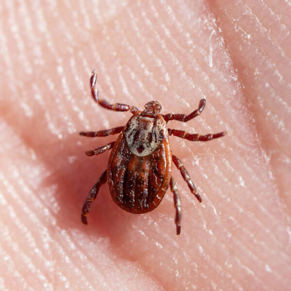Female blood-sucking mite crawling on a human skin macro. Dangerous contagious parasite