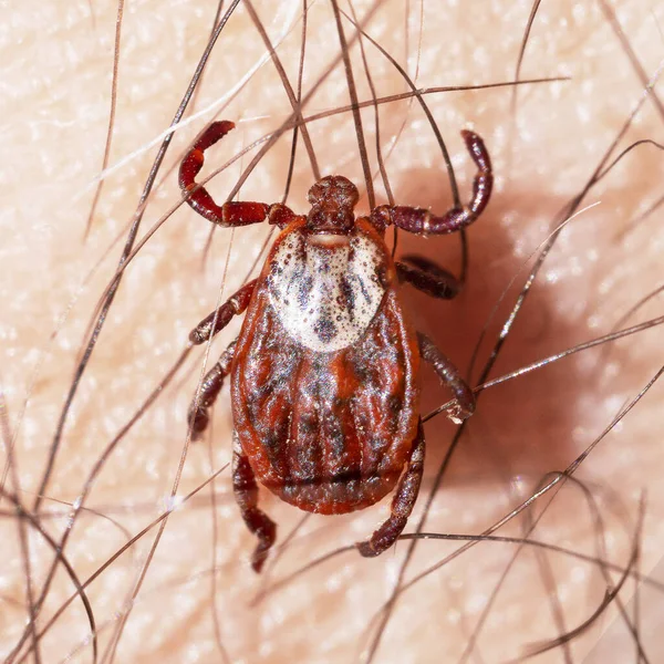 一个雌性吸血螨爬行在毛茸茸的人类皮肤上的宏观照片 危险的传染性寄生虫 — 图库照片