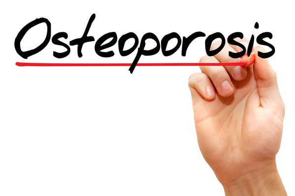 Osteoporosis — Foto de Stock