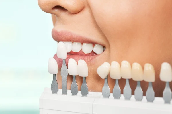 Mujer Comprobación del color de los dientes — Foto de Stock