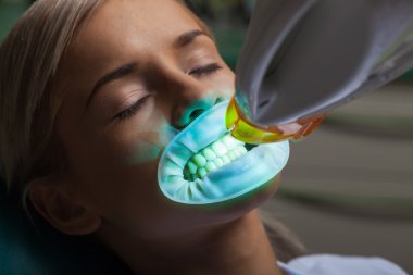 ultraviyole lamba doldurma dişleri olan kadın