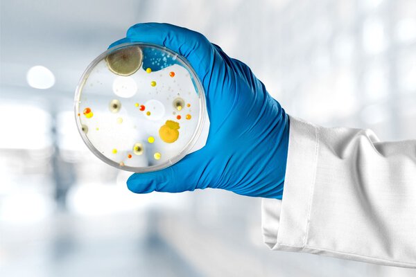 microbiology laboratory test in scientist hand