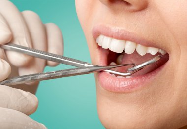 Kadın dişleri ve dişçi ağız aynası.