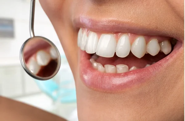 Woman teeth and a dentist mouth mirror — Stock Photo, Image