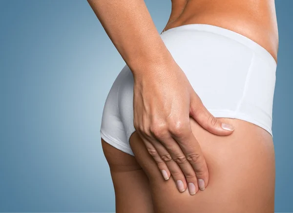 Woman with checking cellulite on her buttocks — Stock Photo, Image