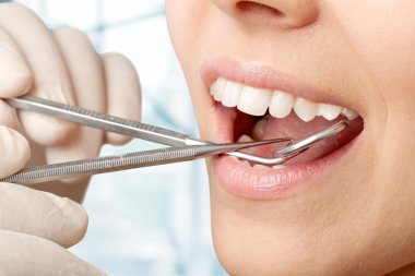 Kadın dişleri ve dişçi ağız aynası.