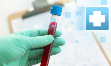 Erkek el, laboratuvar deney tüpünü kanla tutuyor.