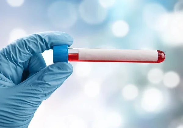 Infirmière Tenant Tube Test Sanguin Avec Étiquette Vierge — Photo
