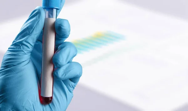 Laboratuvarda Kırmızı Sıvıyla Test Tüpü Tutan Bir Doktorun Yakın Çekimi — Stok fotoğraf