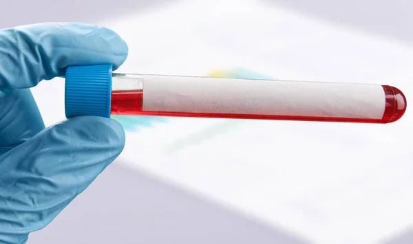 Kırmızı Sıvıyla Test Tüpünü Tutan Bir Elin Yakın Çekimi — Stok fotoğraf