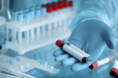 Elinde kırmızı sıvıyla test tüpü tutan bir bilim adamının yakın çekimi.