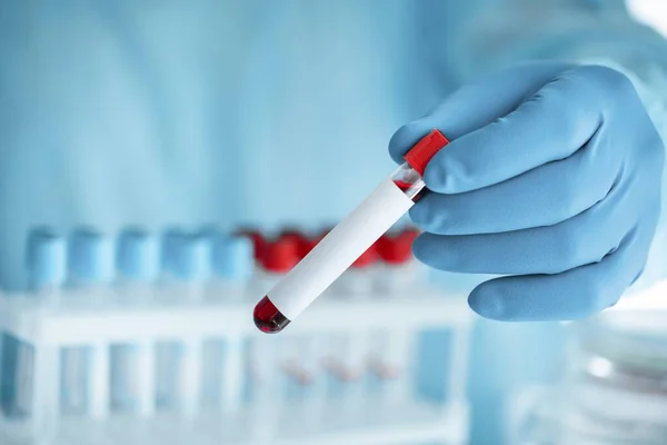 Elinde Kırmızı Sıvıyla Test Tüpü Tutan Bir Bilim Adamının Yakın — Stok fotoğraf