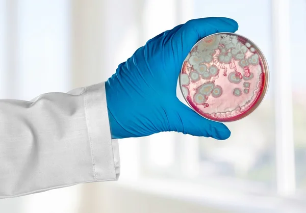 Analyze, background, bacteria. — Stock Photo, Image