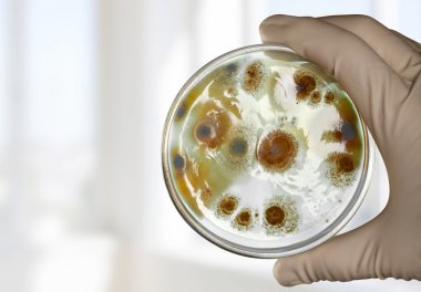 Petri, dish, enterococcus. clipart