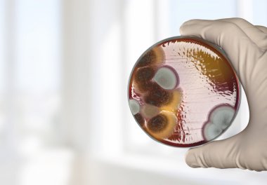 Petri, dish, enterococcus. clipart