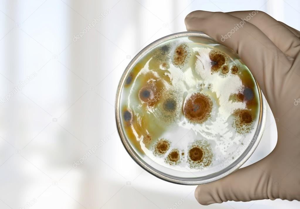 Petri, dish, enterococcus.