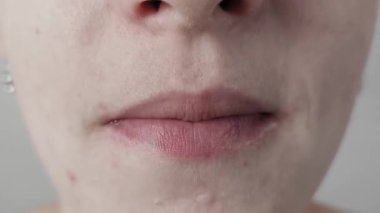 Diliyle dudaklarını yalayan bir kadının aşırı yakın plan çekimi. Makro görüntüler sivilceli kusurlu bir cildi ön plana çıkarıyor. Tarafsız gri bir arkaplanda kışkırtıcı ve düşünceli bir hareket sergiliyor..