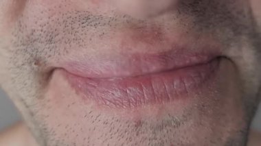 Derisi sorunlu bir kadının ağzına aşırı yakın çekim. Tarafsız bir ifadeden geniş dişli bir gülümsemeye geçişler beyaz dişleri ve pembe diş etlerini gri bir arkaplanda ortaya çıkarıyor..