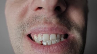 Geniş, manik bir kahkahaya dalan sakallı bir adamın önden makro görüntüsü. Dişetlerini ve çarpık dişlerini gösteriyor. Çılgınlık, neşe ya da yoğun bir eğlence duygusu taşıyor..