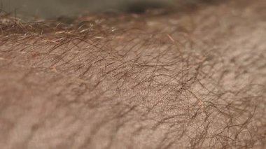 Makro bir perspektif, insan derisinin karmaşık detaylarını gözler önüne serer. Bireysel saç köklerini ve kolun yüzeyini kaplayan ince kıllı üst derinin ince dokusunu gösterir..