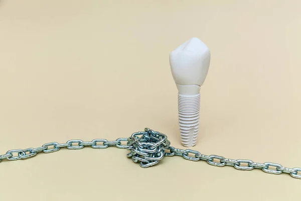 Dental Implant Twisted Metal Chain Beige Background Dental Implant Model — Stock Photo, Image