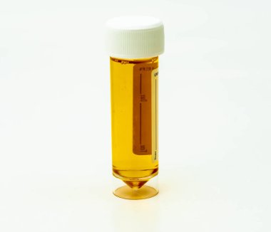 Urine sample in a plastic specimen container, isolated on a white background. . High quality photo
