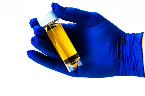 Urine Sample Plastic Container Held Hand Wearing Blue Medical Rubber — Stock Photo, Image