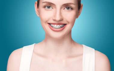 Diş telleri ile mutlu güzel kız