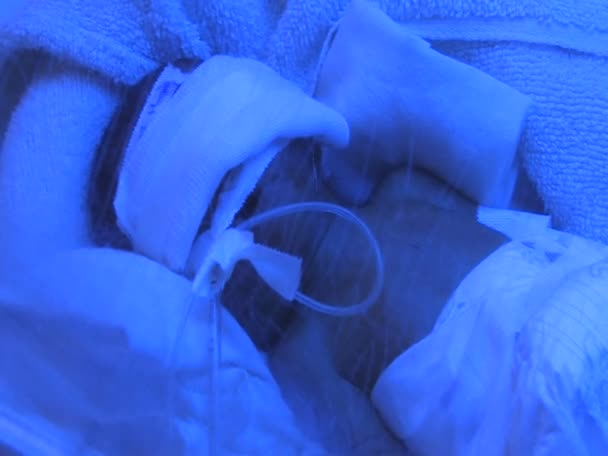О новорожденном ребёнке заботятся в инкубаторе — стоковое видео