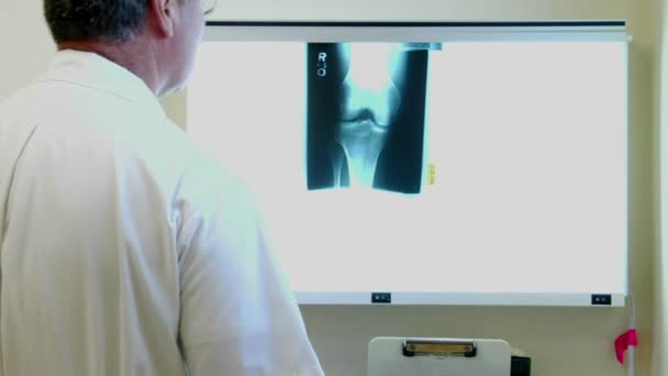 Un medico esamina le radiografie — Video Stock