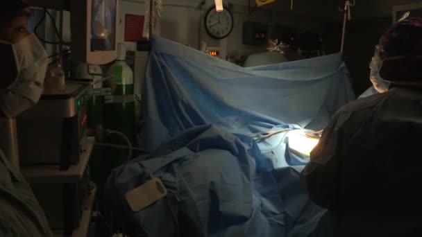 Una cirugía se realiza en un quirófano — Vídeos de Stock
