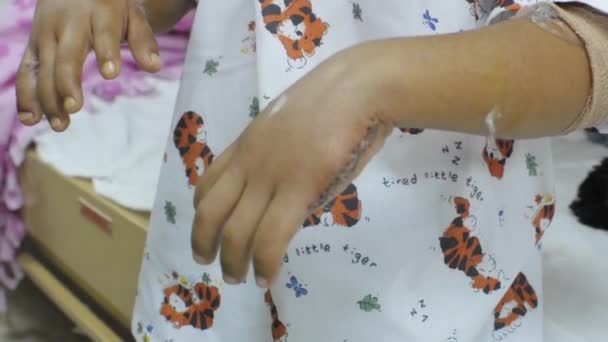 一个孩子正接受整容手术 — 图库视频影像