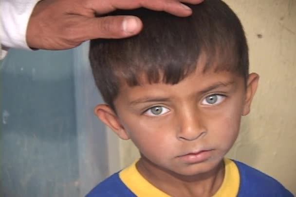 Boy visar effekterna av kriget — Stockvideo