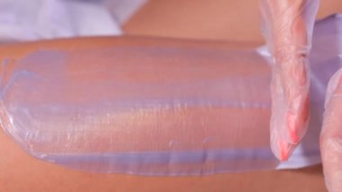 Tedavi odasında ağda.