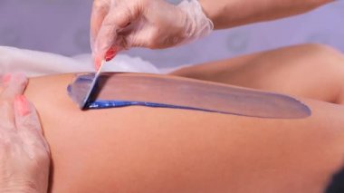 Tedavi odasında ağda.