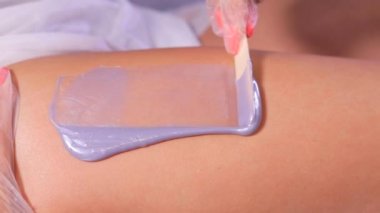 Tedavi odasında ağda.