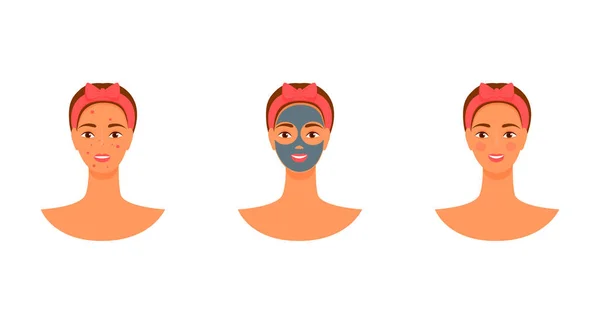 Vector mujer yang máscara facial. acné antes y después. cuidado de la piel ilustración plana. — Vector de stock