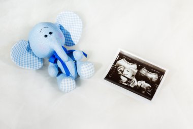 Baby toy and ultrasound scan of baby clipart