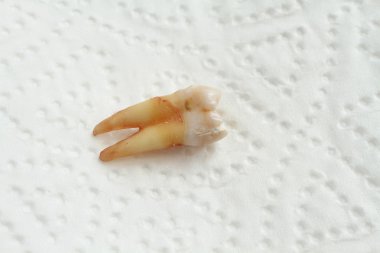 Diş beyaz kağıt peçete üzerinde kaldırmak