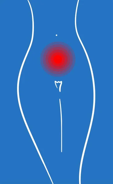 Захист Гігієни Жінки Менструації Гігієнічні Прокладки Критичні Дні Жінок Цикл — стоковий вектор