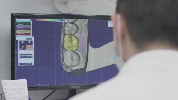 Medico dentista lavora su un computer in un programma 3D. Crea un modello di una protesi della mascella e denti in ceramica. Esegue la diagnostica della cavità orale. Applicazione delle nuove tecnologie in odontoiatria — Video Stock