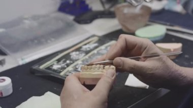 Bir dişçi, laboratuarda çene protezi ve seramik diş modeli yaratır. Diş implantlarına fırçayla boya sür. Yapay dişler. Diş hekimliğinde yeni teknolojilerin uygulanması