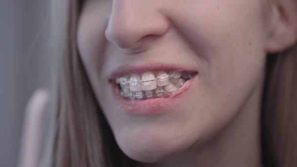 Femeia curăță aparatele dentare cu irigator dentar de apă. Fata are grijă de sistemul de aparate dentare pe dinți. Curăță dinții cu apă portabilă Flosser dinți dentari electrici irigator oral — Videoclip de stoc